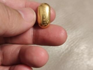 熊孩子误吞10克重金豆6天后排出 妈妈:天天叮嘱他不要在外面拉屎