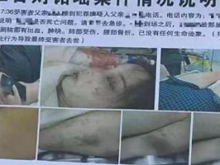 河北孟村县一女子去世，与丈夫家暴有关？多方回应：警方已介入