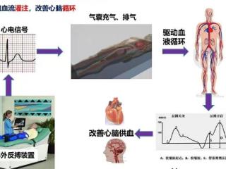 济南市四院科普｜体外反搏为血管性眼病患者点亮希望之光