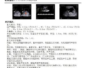 青岛市妇女儿童医院产科超声全新上线NT“进阶版”