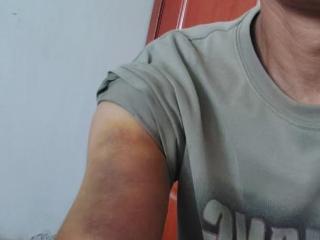河南一男子称因发视频反映村干部家占道遭殴打 多方回应