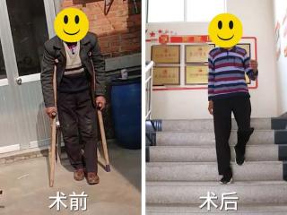 从拄拐蹒跚到健步如飞，济南关节外科医院帮临沂大叔重拾健康生活