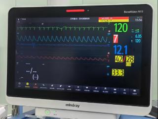 7%血氧生死救援！山东大学附属儿童医院成功抢救危重先心病患儿