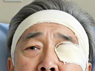 关爱眼睛 固本明目即时缓解眼部干涩不适
