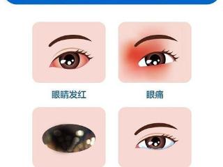 济南市二院科普|眼睛发红、疼痛？当心！可能是患上了葡萄膜炎