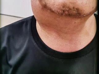精准抗癌创奇迹！济南市五院肿瘤血液科成功救治晚期下咽癌患者