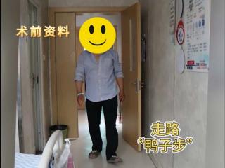 机器人+DAA入路,精准微创恢复快，不负患者17年的等待