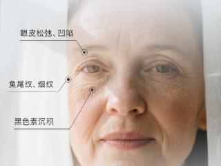 眼周抗衰新视角：来自北京好年华的专业见解