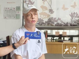 励志！池州烧伤少年方益凡：经历23次手术后的高考逆袭
