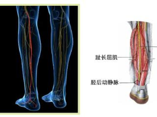 泰安市第一人民医院：120急救分站高效联动，多学科无缝衔接缝合患者下肢生命线