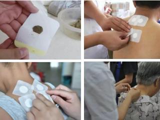 青岛西海岸第二医院三伏贴即将开贴！赶快预约！错过又要再等一年！