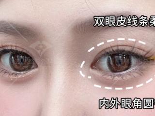 杏林整形：如何获得妈生双眼皮？