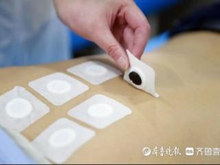 冬病夏治好时节｜滕州市康复医院“三伏贴”开始预约