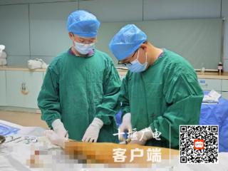 健康问太和 | 射频消融术可以消除“蚯蚓腿”，这是真的吗？