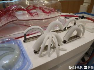 走在最前沿|人工血管是如何“织”出来的