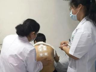 三伏贴即将开贴，错过要再等一年！快来宁阳县第一人民医院趁热打“贴”吧