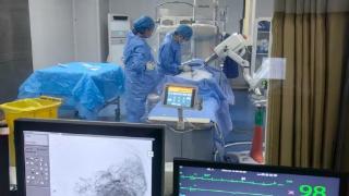 曹县中医医院成功开展两例脑血管造影术
