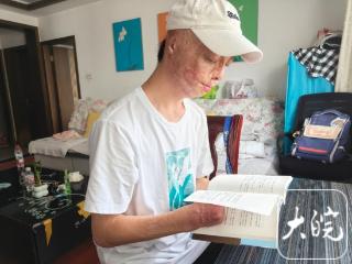 祝贺！烧伤男孩方益凡被东南大学录取