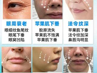 杏林整形：皱纹、松弛、下垂、垮脸？这份抗衰攻略快收好！