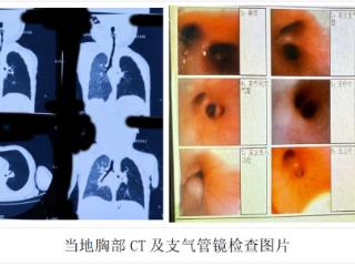 跨越千里的生命接力！山东大学附属儿童医院成功救治疑难重症患儿