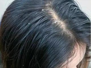 舒蕾第九代绿茶籽洗发露：72h控油+48h蓬松，拯救夏日油痒塌