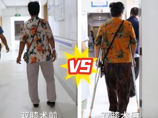 机器人助力膝关节炎患者快速康复，济南关节外科医院不负二次信任