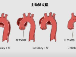 在举目无亲的城市，36天抢救闯过数个危险关口