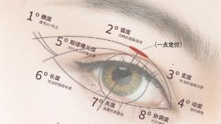 北京好年华眼整形中心：“一点双眼皮”技术的革新与实践‌