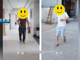 30多岁小伙股骨头坏死拄拐多年，天津到济南终找回健康双腿