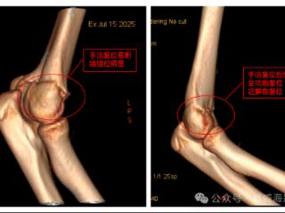 威海：骨折游客主动延长假期，这座城市有何魅力？