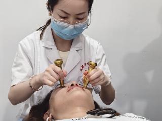 非物质文化遗产太极杵针疗法 让中医美容锦上添花
