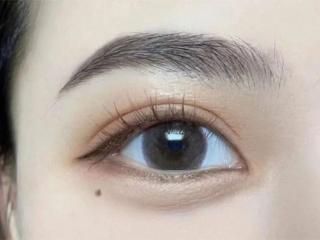 厦门做祛眼袋手术怎么选？厦门美莱品质塑美 眼整形享大额福利补贴