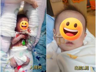 小叶医探 | 出生时体重仅475克，24周早产宝宝如今迎来“新生”