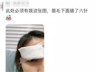 碳音球真能“扎穿眉骨”？科学拆解运动损伤谣言