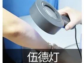 孩子得了白癜风，究竟该做哪些检查？来看看济南中医怎么说