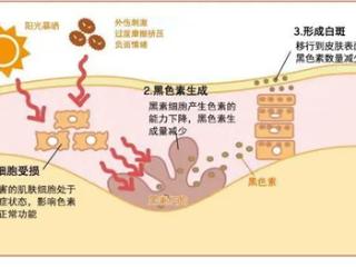 秋季巩固治疗必不可少！北京白癜风专家济南会诊倒计时
