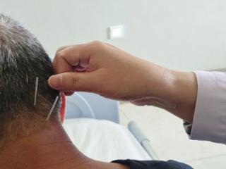 平度市第三人民医院康复科：醒脑开窍+放血疗法，助力偏瘫患者重拾健康