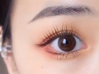 埋线、微创、全切，哪种双眼皮术式更适合你？厦门美莱眼整形享福利补贴