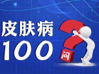 告别反复！济南中研皮肤科医生：脂溢性皮炎科学应对指南