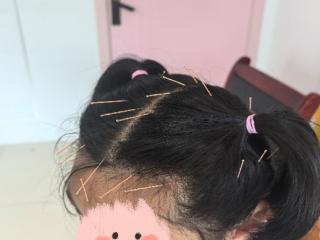 小叶医探|用“针尖”点亮“星光” 帮助“星星的孩子”走出孤独