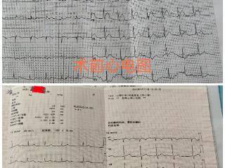 争分夺秒，极速救“心” 曹县中医医院胸痛中心一小时内成功救治高龄心梗患者
