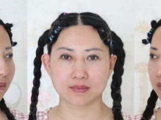 杏林除皱：“岁月也会败美人”，这些年龄感元凶分层解决才对