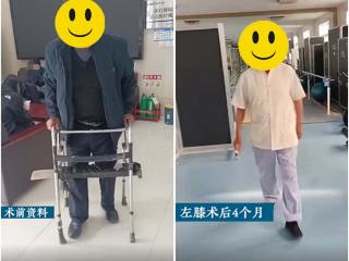 告别助行器！济南关节外科医院帮70岁大爷治好膝关节炎