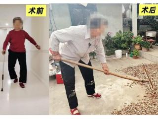 18年双膝关节痛折磨 济南南郊医院助七旬老人重拾生活信心