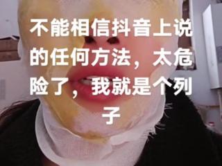 女子模仿网络“妙招”除水垢被沸水烫伤面部 专业人士支招除水垢方法
