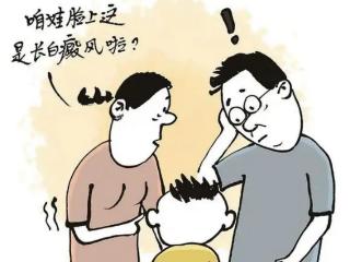 孩子得了白癜风，家长需要注意什么？济南哪家医院治疗效果比较好