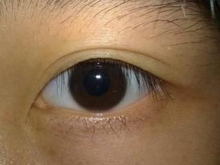 无惧时光守护银龄，十一月启冬护视界！南昌普瑞白内障防治指南：让「飞白」为清晰护航