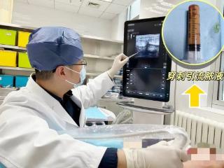 专治乳腺炎！彩超评估+安全用药+专业通乳+穿刺引流，化解“胸”险有了一站式方案