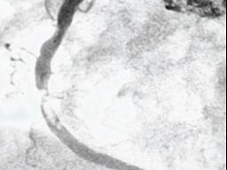 警惕心梗！福州一男子险丢命！