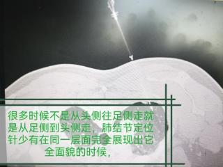 【健康科普】肺磨玻璃结节：发现后别慌，精准定位是关键